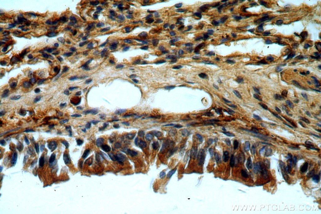 Immunohistochemical of  paraffin-embedded human lung using 20409-1-AP(C11orf51 antibody) at dilution of 1:50 (under 40x lens)