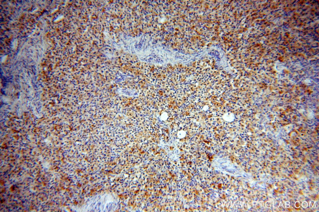 Immunohistochemical of  paraffin-embedded human ovary using 20414-1-AP(C11orf67 antibody) at dilution of 1:50 (under 10x lens)