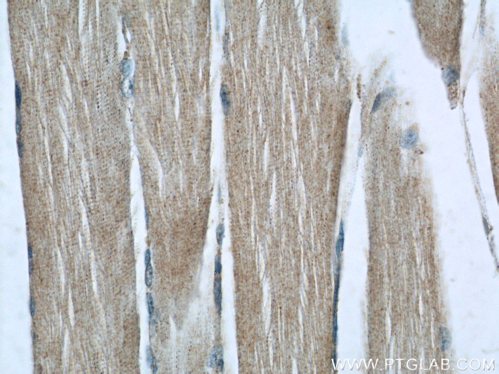 Immunohistochemistry of paraffin-embedded human skeletal muscle slide using 22664-1-AP( C14orf39 Antibody) at dilution of 1:50