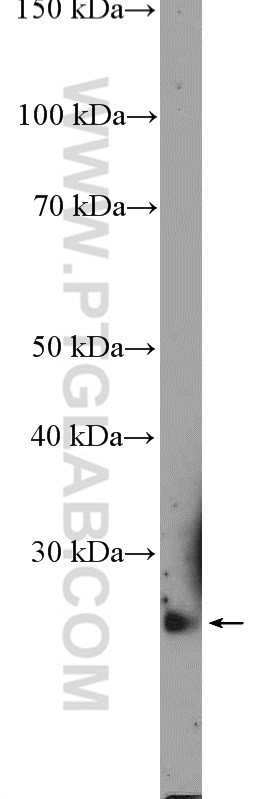Mouse thymus tissue were subjected to SDS PAGE followed by western blot with 26113-1-AP( C19orf20 Antibody) at dilution of 1:600