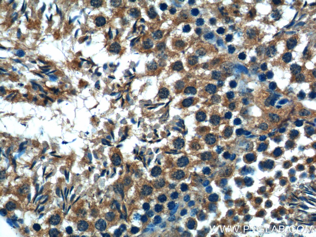 Immunohistochemistry of paraffin-embedded mouse testis tissue slide using 25650-1-AP( C19orf36 Antibody) at dilution of 1:50 (under 40x lens)