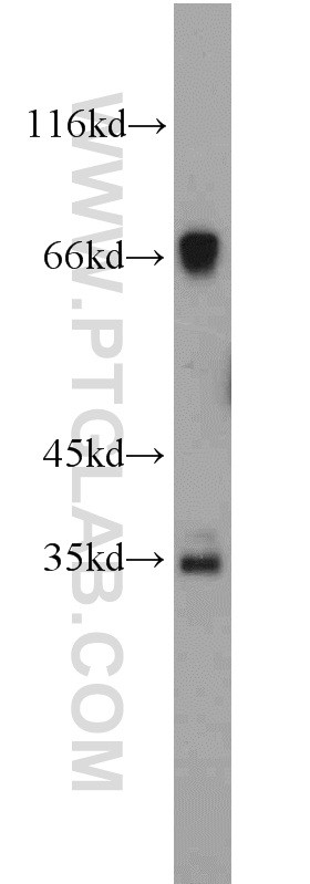 Mouse liver tissue were subjected to SDS PAGE followed by western blot with 21503-1-AP(C19orf44 antibody) at dilution of 1:500