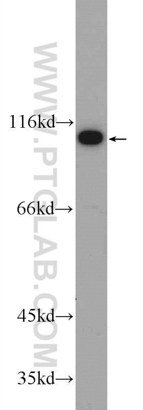 A2780 cells were subjected to SDS PAGE followed by western blot with 25050-1-AP( C19orf57 Antibody) at dilution of 1:1000