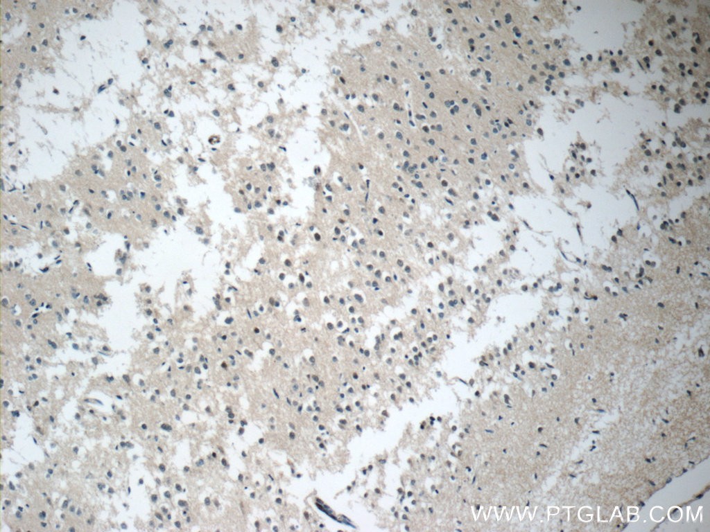 Immunohistochemistry of paraffin-embedded human brain tissue slide using 25024-1-AP( C21orf58 Antibody) at dilution of 1:50 (under 10x lens)