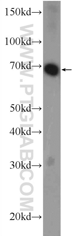 Mouse brain tissue were subjected to SDS PAGE followed by western blot with 25970-1-AP( RCOR3 Antibody) at dilution of 1:600