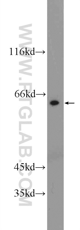 A431 cells were subjected to SDS PAGE followed by western blot with 55173-1-AP( RCOR3 Antibody) at dilution of 1:600