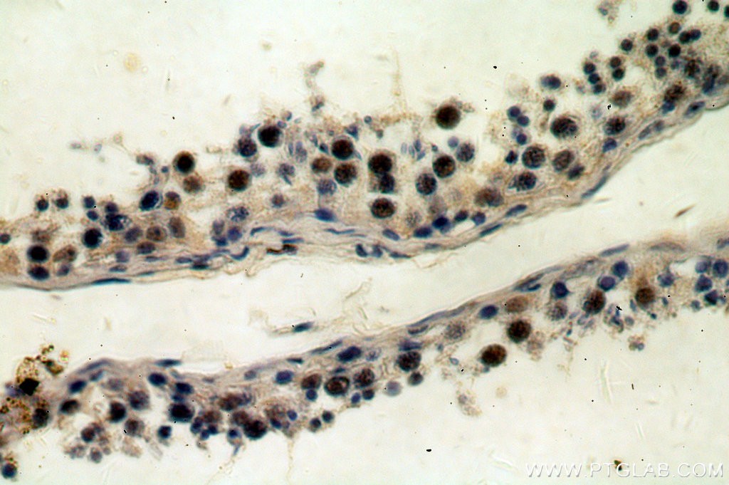 Immunohistochemical of  paraffin-embedded human testis using 18890-1-AP(REXO4,REX4 antibody) at dilution of 1:100 (under 40x lens)