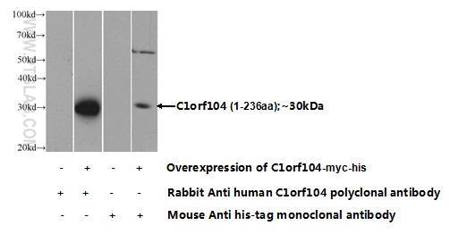 Transfected HEK-293 cells were subjected to SDS PAGE followed by western blot with 24360-1-AP( C1orf104 Antibody) at dilution of 1:1000