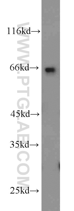 PC-3 cell were subjected to SDS PAGE followed by western blot with 14888-1-AP(C1orf116 Antibody) at dilution of 1:800
