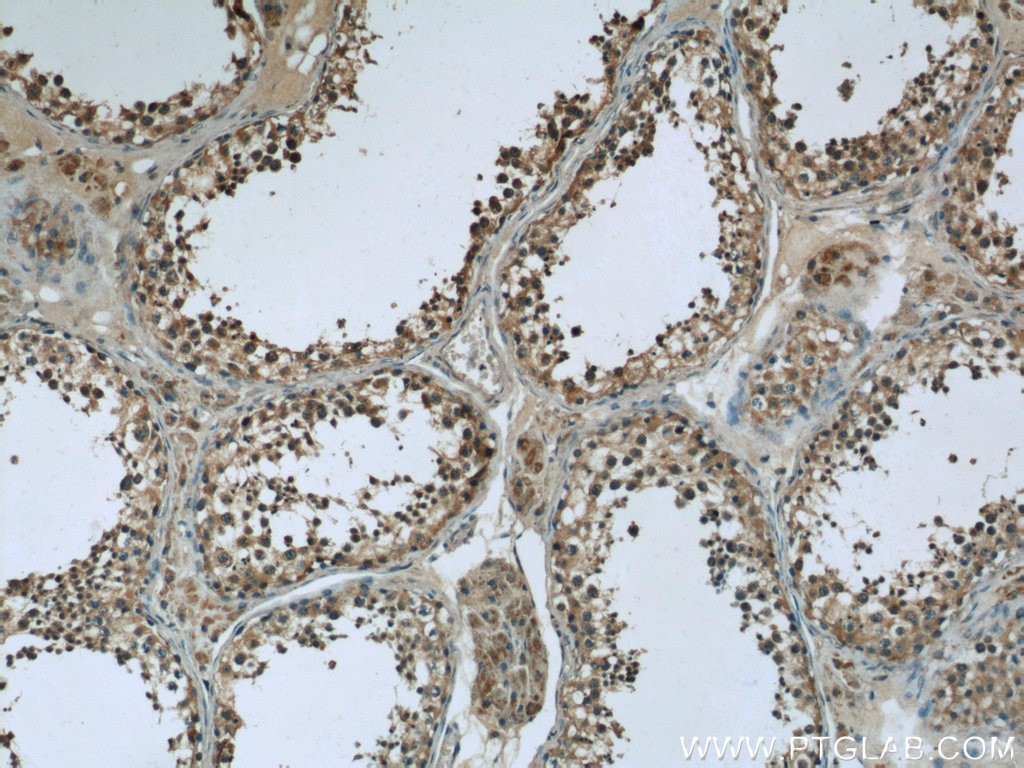 Immunohistochemistry of paraffin-embedded human testis slide using 24429-1-AP( C1orf223 Antibody) at dilution of 1:50 (under 10x lens)