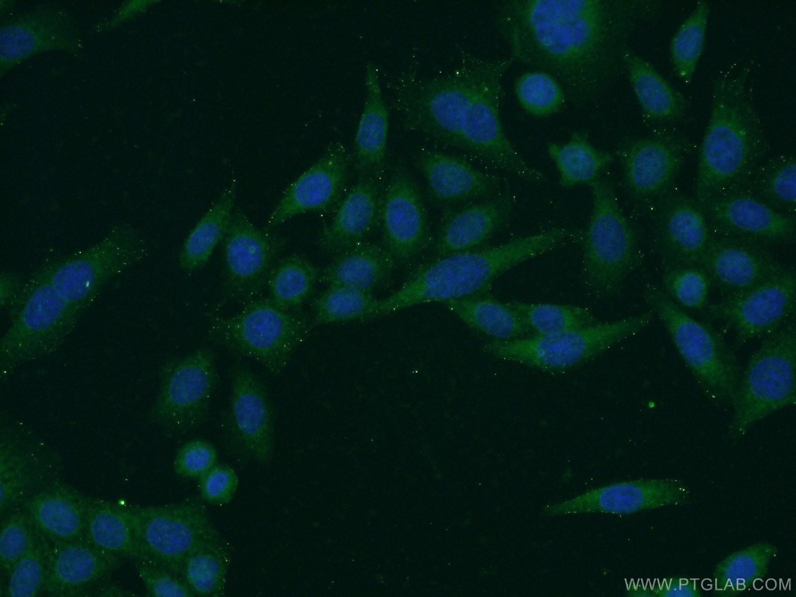 Immunofluorescent analysis of HeLa cells using 21031-1-AP( C1orf92 Antibody) at dilution of 1:50 and Alexa Fluor 488-congugated AffiniPure Goat Anti-Rabbit IgG(H+L)