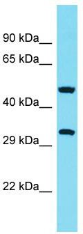 Host: Rabbit; Target Name: ABHD10; Sample Tissue: THP-1 Whole Cell lysates; Antibody Dilution: 1.0ug/ml