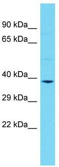 Host: Rabbit; Target Name: Clmp; Sample Tissue: Rat Stomach lysates; Antibody Dilution: 1.0 ug/ml
