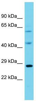 Host: Rabbit; Target Name: Paox; Sample Tissue: Rat Pancreas lysates; Antibody Dilution: 1.0 ug/ml