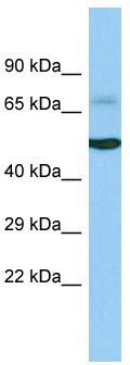Host: Rabbit; Target Name: ACOXL; Sample Tissue: Fetal Liver lysates; Antibody Dilution: 1.0ug/ml