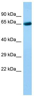 Host: Rabbit; Target Name: ACOXL; Sample Tissue: Fetal Liver lysates; Antibody Dilution: 1.0ug/ml