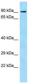 Host: Rabbit; Target Name: Acsl4; Sample Tissue: Mouse Thymus lysates; Antibody Dilution: 1.0 ug/ml