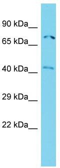 Host: Rabbit; Target Name: ACTR8; Sample Tissue: Jurkat Whole Cell lysates; Antibody Dilution: 1.0 ug/ml.