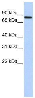 WB Suggested Anti-ADARB2 Antibody Titration: 0.2-1 ug/ml; ELISA Titer: 1: 312500; Positive Control: Human heart
