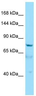 Host: Rabbit; Target Name: AKNA; Sample Tissue: HepG2 Whole Cell lysates; Antibody Dilution: 1.0 ug/ml
