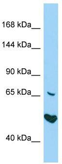 Host: Rabbit; Target Name: AKNA; Sample Tissue: HepG2 Whole Cell lysates; Antibody Dilution: 1.0 ug/ml