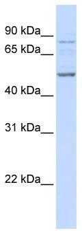 WB Suggested Anti-ALS2CR12 Antibody Titration: 0.2-1 ug/ml; ELISA Titer: 1: 62500; Positive Control: MCF7 cell lysate