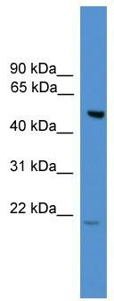 WB Suggested Anti-ALS2CR12 Antibody Titration: 0.2-1 ug/ml; ELISA Titer: 1: 1562500; Positive Control: A549 cell lysate