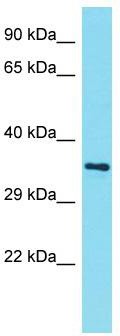 Host: Rabbit; Target Name: AMMECR1L; Sample Tissue: NCI-H226 Whole Cell lysates; Antibody Dilution: 1.0 ug/ml.