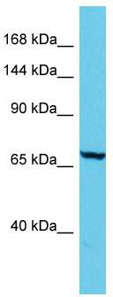Host: Rabbit; Target Name: ADGB; Sample Tissue: Jurkat Whole Cell lysates; Antibody Dilution: 1.0ug/ml