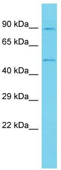 Host: Rabbit; Target Name: ANKRD10; Sample Tissue: U937 Whole Cell lysates; Antibody Dilution: 1.0ug/ml