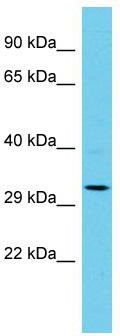 Host: Rabbit; Target Name: AP1AR; Sample Tissue: Jurkat Whole Cell lysates; Antibody Dilution: 1.0ug/ml