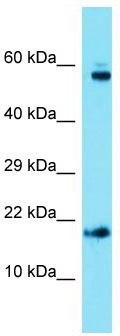 Host: Rabbit; Target Name: Ap1s1; Sample Tissue: Mouse Heart lysates; Antibody Dilution: 1.0ug/ml