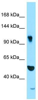 WB Suggested Anti-SYNRG Antibody; Titration: 1.0 ug/ml; Positive Control: PANC1 Whole Cell