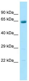 WB Suggested Anti-ARSJ Antibody; Titration: 1.0 ug/ml; Positive Control: Fetal Lung
