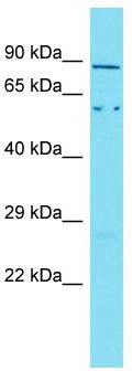 Host: Rabbit; Target Name: Aste1; Sample Tissue: Mouse Heart lysates; Antibody Dilution: 1.0ug/ml