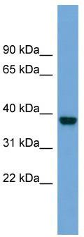 WB Suggested Anti-ATP1B4 Antibody Titration: 0.2-1 ug/ml; Positive Control: COLO205 cell lysate