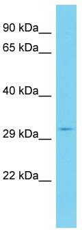 Host: Rabbit; Target Name: ATP5SL; Sample Tissue: Jurkat Whole Cell lysates; Antibody Dilution: 1.0ug/ml
