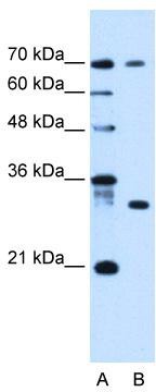 WB Suggested Anti-ATP6AP1L Antibody Titration: 0.2-1 ug/ml; Positive Control: HepG2 cell lysate