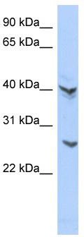 WB Suggested Anti-ATP6V0E2 Antibody Titration: 0.2-1 ug/ml; ELISA Titer: 1: 1562500; Positive Control: COLO205 cell lysate