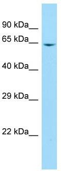 Host: Rabbit; Target Name: B4GALNT2; Sample Tissue: Jurkat Whole Cell lysates; Antibody Dilution: 1.0 ug/ml