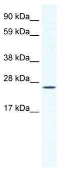 WB Suggested Anti-BRF1 Antibody Titration: 1.25ug/ml; ELISA Titer: 1:62500; Positive Control: NIH/3T3 cell lysate