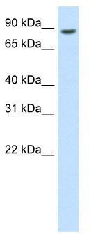 WB Suggested Anti-BRF1 Antibody Titration: 0.2-1 ug/ml; ELISA Titer: 1: 312500; Positive Control: Human Thymus