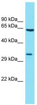 Host: Rabbit; Target Name: BTBD19; Sample Tissue: 721_B Whole Cell lysates; Antibody Dilution: 1.0 ug/ml