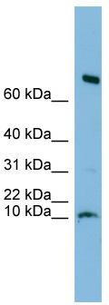 WB Suggested Anti-C1orf122 Antibody Titration: 0.2-1 ug/ml; ELISA Titer: 1: 1562500; Positive Control: Human heart