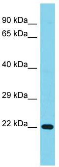 Host: Rabbit; Target Name: C1orf158; Sample Tissue: Jurkat Whole Cell lysates; Antibody Dilution: 1.0 ug/ml.