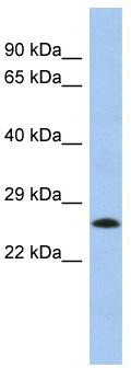 WB Suggested Anti-MGC50273 Antibody Titration: 0.2-1 ug/ml; ELISA Titer: 1:312500; Positive Control: Human Lung