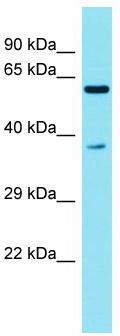 Host: Rabbit; Target Name: C3orf30; Sample Tissue: Fetal Liver lysates; Antibody Dilution: 1.0 ug/ml