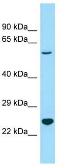 WB Suggested Anti-1190002N15Rik Antibody; Titration: 1.0 ug/ml; Positive Control: Mouse Testis