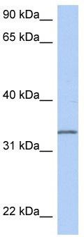 WB Suggested Anti-C3orf62 Antibody Titration: 0.2-1 ug/ml; ELISA Titer: 1:62500; Positive Control: MCF7 cell lysate