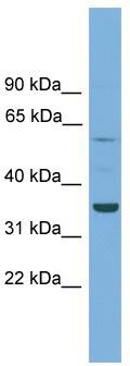 WB Suggested Anti-C3orf67 Antibody Titration: 0.2-1 ug/ml; ELISA Titer: 1: 312500; Positive Control: OVCAR-3 cell lysate